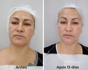 Royal Face Estética Betim