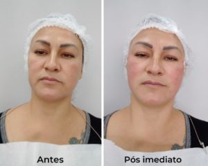 Royal Face Estética Betim
