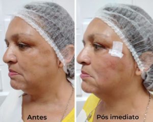 Royal Face Estética Betim