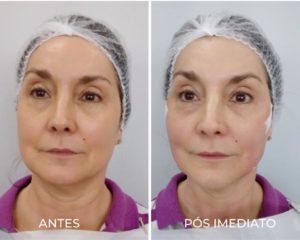 Royal Face Estética Betim