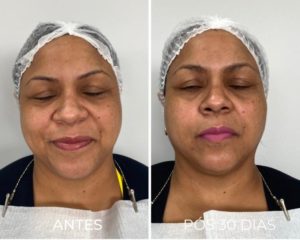 Royal Face Estética Betim