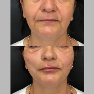Royal Face Estética Betim