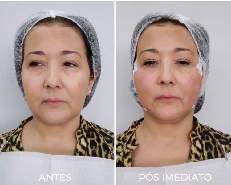 Royal Face Estética Betim