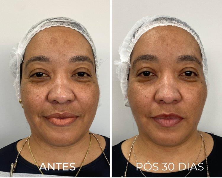 Royal Face Estética Betim