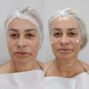 Royal Face Estética Betim