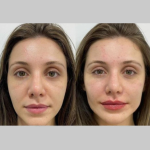 Royal Face Estética Betim