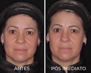 Royal Face Estética Betim