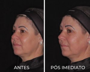 Royal Face Estética Betim