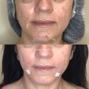 Royal Face Estética Betim