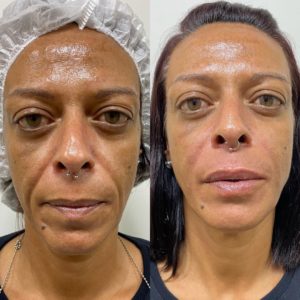 Royal Face Estética Betim
