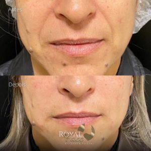 Royal Face Estética Betim