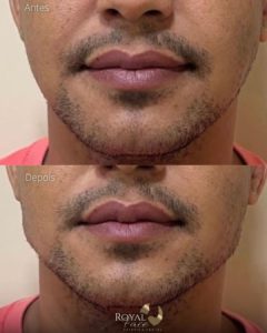 Royal Face Estética Betim