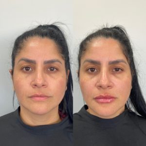 Royal Face Estética Betim