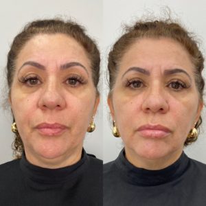Royal Face Estética Betim