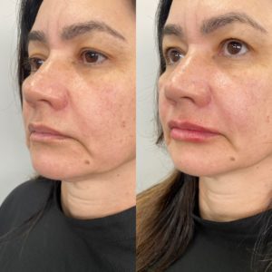 Royal Face Estética Betim
