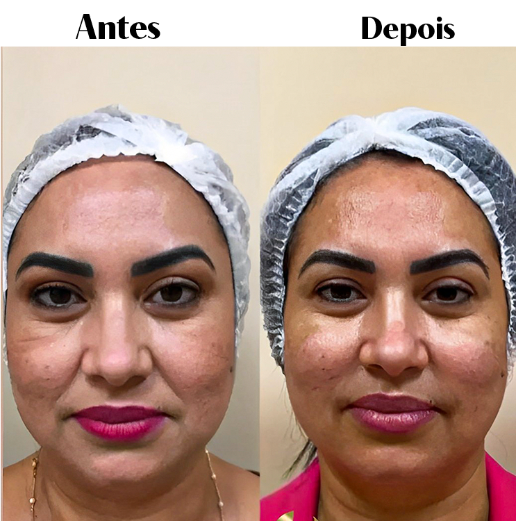 Royal Face Estética Betim
