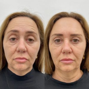Royal Face Estética Betim