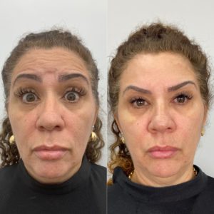 Royal Face Estética Betim