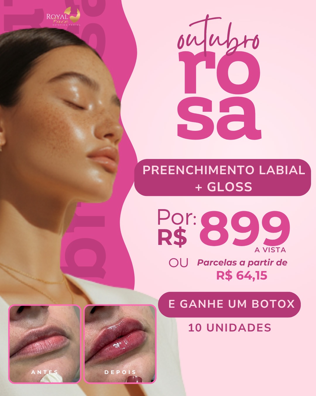 Estética Betim Royal Face Outubro Rosa